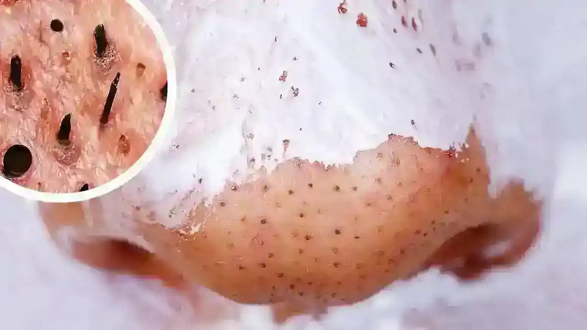 Evde Doğal Cilt Bakım Maskeleri - Işıltılı Bir Cilde Doğru Yolculuk!