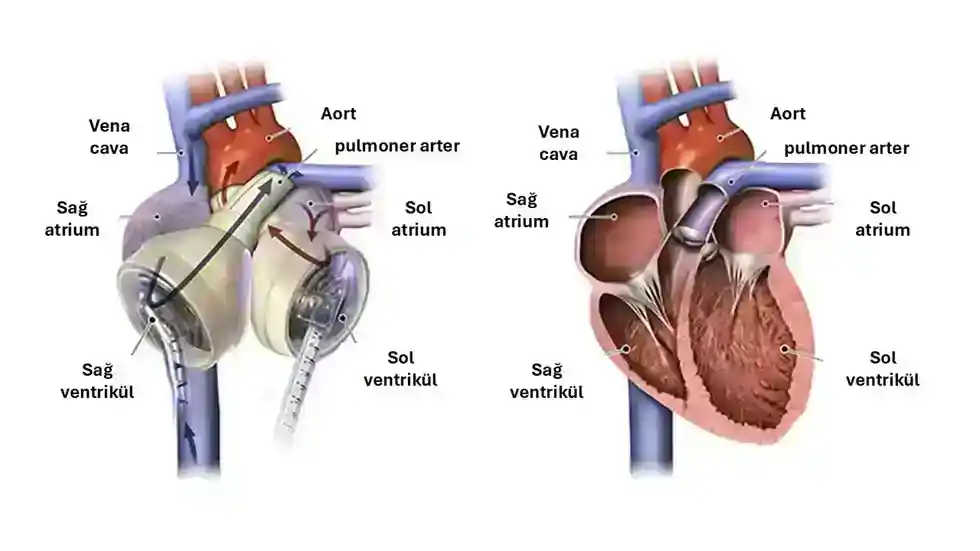 Yapay Organlar: Geleceğin Organları mı?